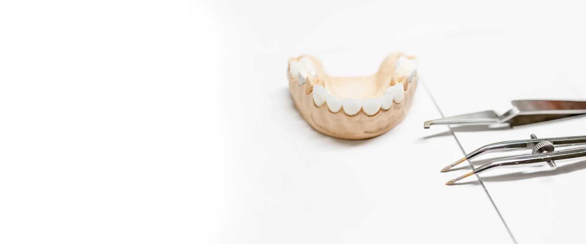 Dental Crowns & Bridges