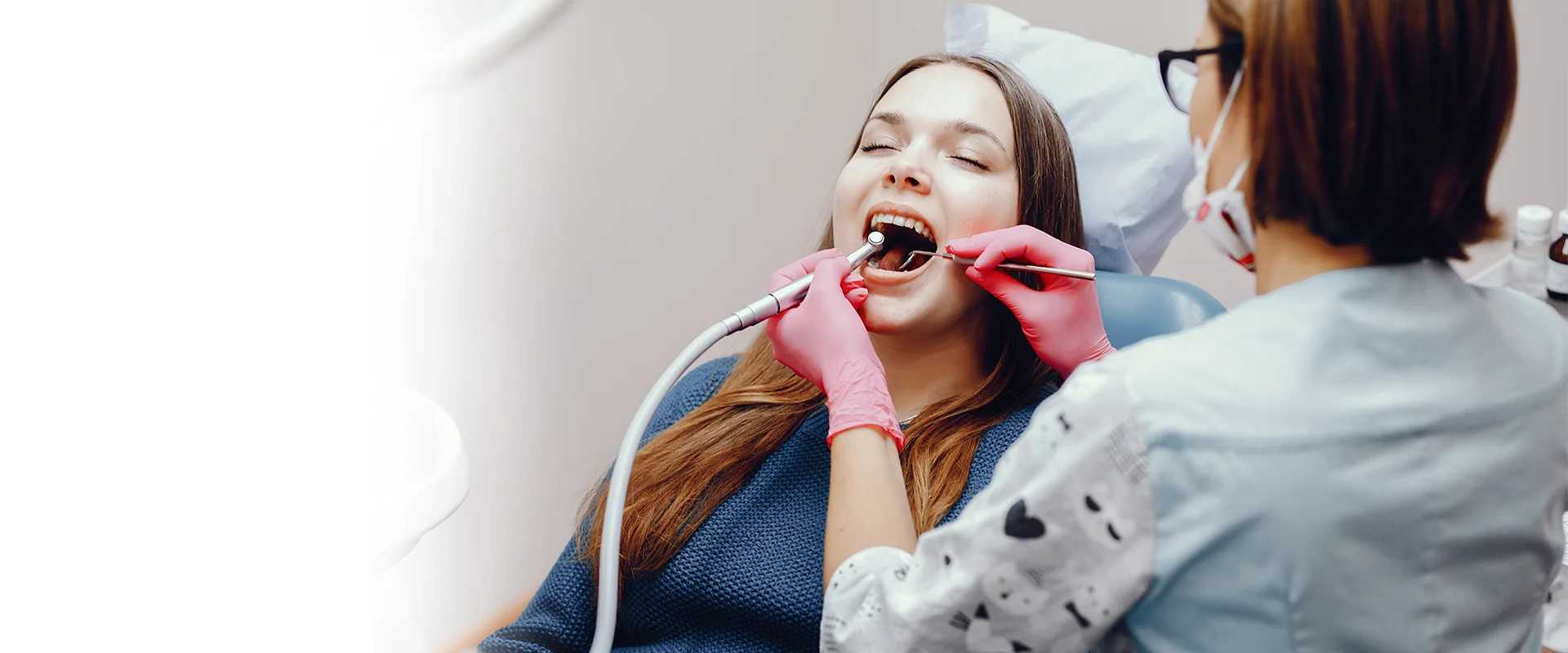 Dental Fillings