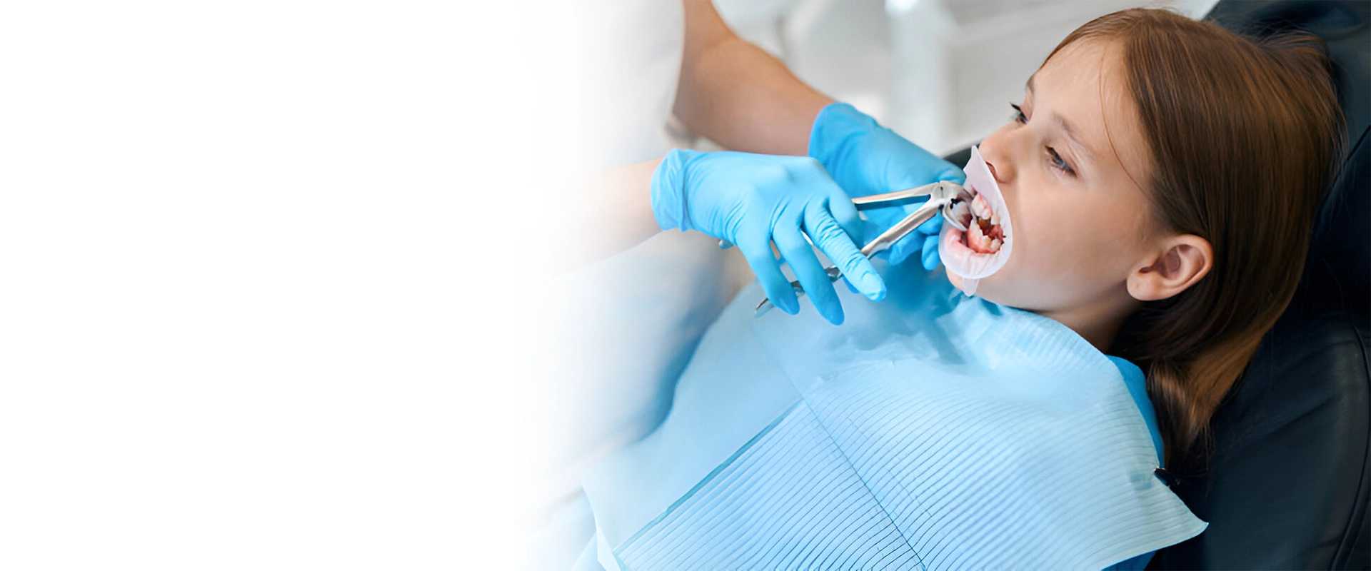 Tooth Extraction