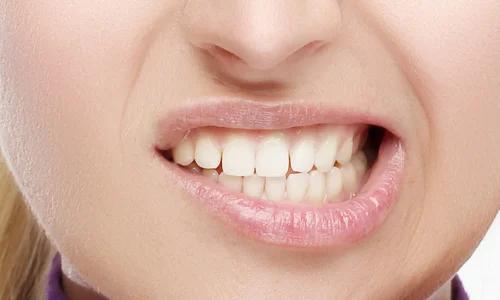 The Impact of Teeth Grinding on Your Health 