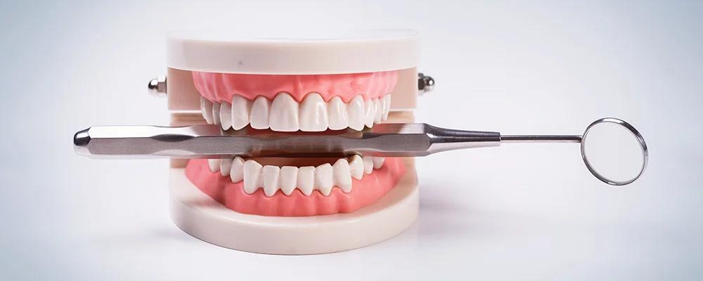 3D Dental Implant Surgery in Dubai