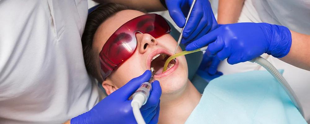 Dental Fillings