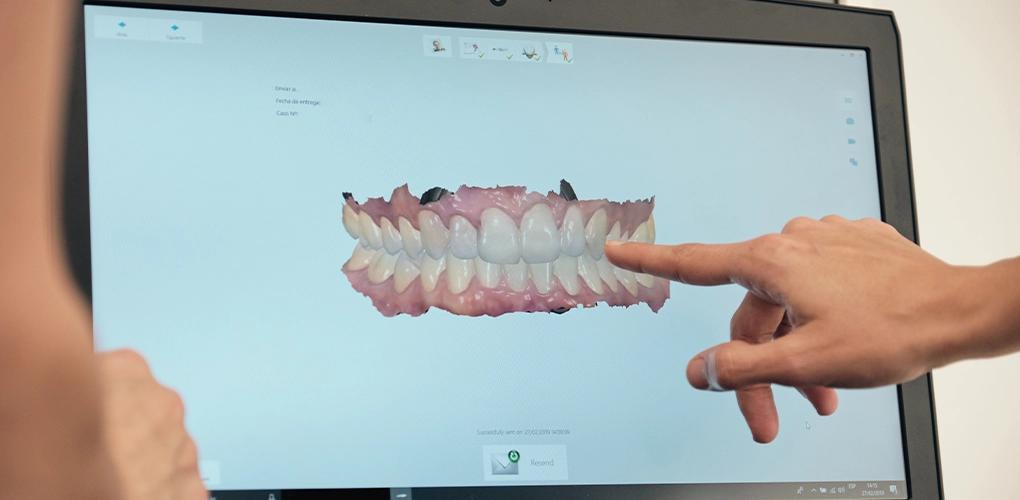 Digital Smile Design